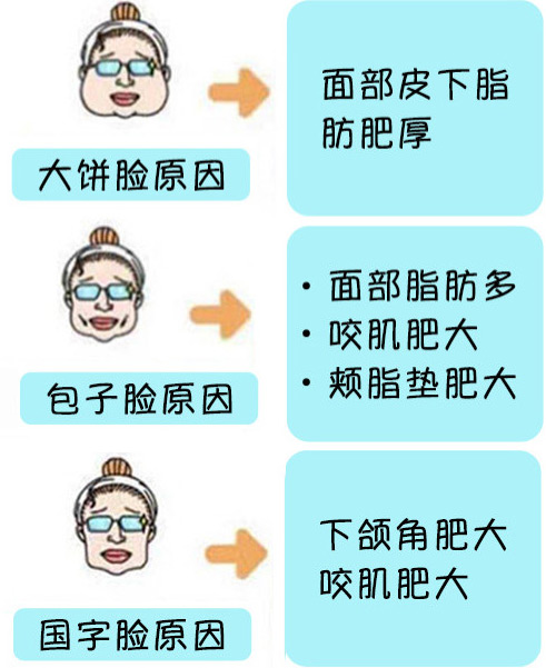 脸大原因