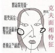 颧骨整形手术后遗症有哪些 颧骨整形手术有风险吗
