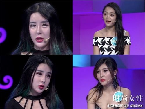 v-line手术整形做出u美人蛇精女李蒽熙