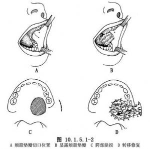 秦皇岛巧致整形医院磨下颌角要多少钱?有风险吗?