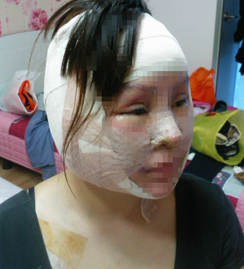 红粉宝宝整容前照片曝光 网友纷纷表示惋惜