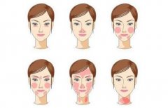 彩光嫩肤手术是什么 夏天适合做彩光嫩肤手术吗