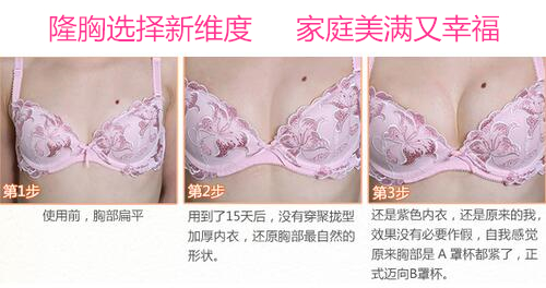 隆胸选择新维度 家庭美满又幸福