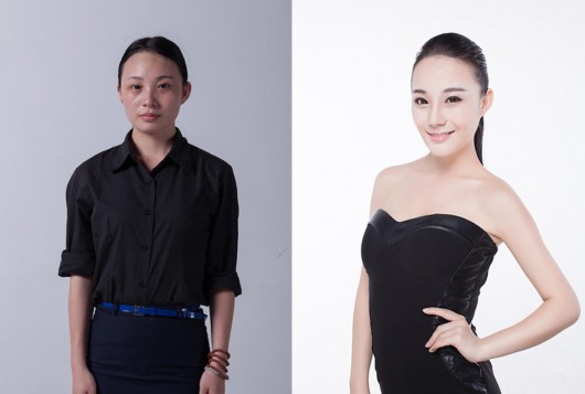 彩光嫩肤手术是什么 夏天适合做彩光嫩肤手术吗