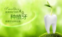 西安做种植牙大概需要多少钱?果怎么样?
