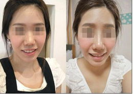 点击查看源网页