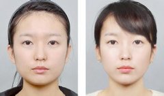 【打B****】打B****的副作用 打B****有多大的危害