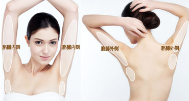 手臂吸脂减肥有什么优势 手臂吸脂价格多少