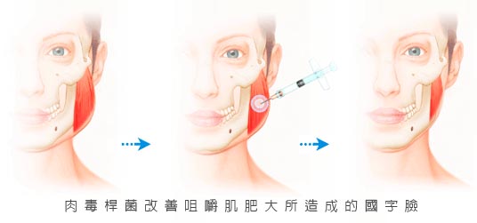 快速有瘦脸的好方法有哪些