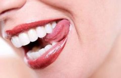 牙畸形怎么办 畸形牙会遗传吗