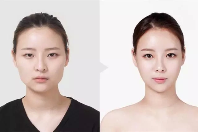 改变脸型的整形方法有几种 哪种方法改脸型喜欢