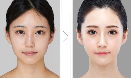 改变脸型的整形方法 韩式精致微创改脸型大概要多少钱