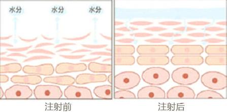 打水光补水价钱高的和价钱便宜的有什么区别呢