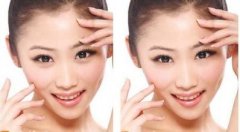 超声波去眼袋的原理是什么 超声波去眼袋的果如何 超声波去眼袋的原理是什么 超声波去眼袋的果如何