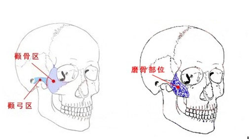 颧骨和颧弓分别在哪