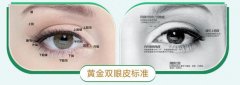 夏天适合做双眼皮手术吗