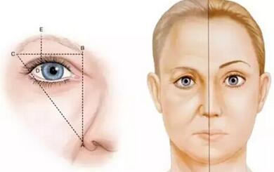 切眉术后如何快速消肿