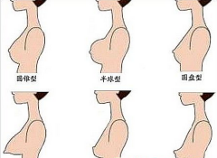 自体脂肪注射丰胸的成好吗 是永.久的吗 自体脂肪注射丰胸的成好吗 是永.久的吗