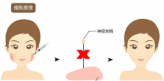 B****会反弹吗 B****去除婴儿肥落实小V脸