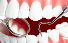 矫正牙齿一般需要多少钱