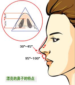 自体软骨隆鼻手术