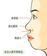 自体软骨隆鼻手术有哪些优点