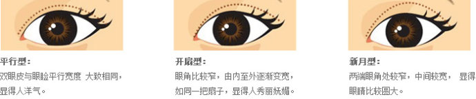 双眼皮和欧式双眼皮对比照片与区别