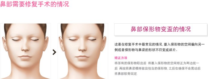 【北京隆鼻修复】北京专业隆鼻医生隆鼻失败修复专家哪个好