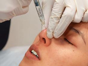 注射玻尿酸隆鼻前后应注意什么