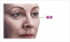 超声波去眼袋降低风险吗 超声波去眼袋有什么后遗症 超声波去眼袋降低风险吗 超声波去眼袋有什么后遗症