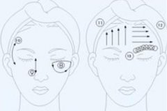【眼部除皱方法】眼部除皱有哪些方法 眼部除皱用什么方法好