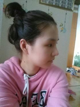 【自体肋软骨隆鼻】自体肋软骨隆鼻优点 自体肋软骨隆鼻对比图