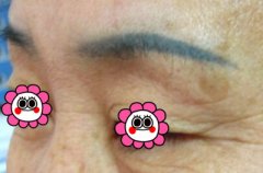 纹眉果怎么样 纹眉果照片 纹眉果怎么样 纹眉果照片