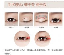 做过双眼皮还能再割么 做过双眼皮还能再割么