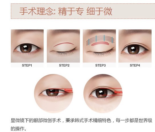 双眼皮