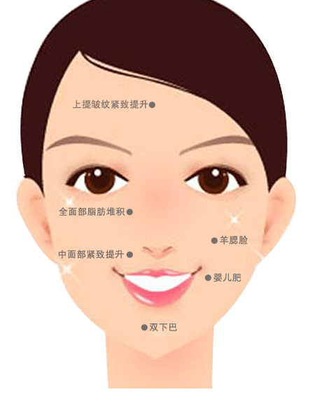 光纤溶脂