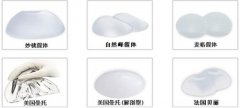 假体丰胸的优势有哪些