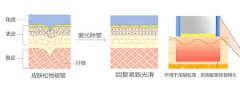 激光去皱有副作用没 激光美白去皱术果怎么样