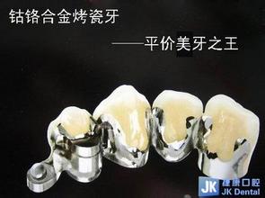 钴铬合金烤瓷牙和钛合金哪种好