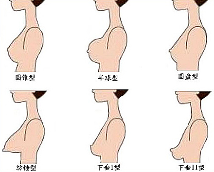 乳房松软下垂的原因