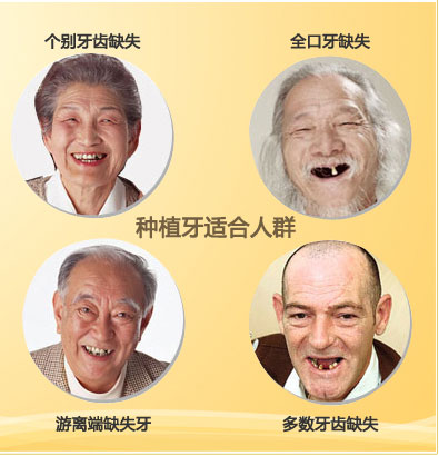 影响种植牙寿命的因素