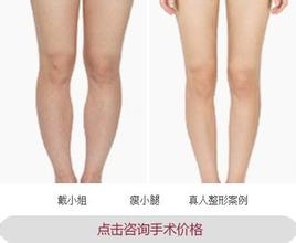注射注射瘦脸瘦小腿果怎么样