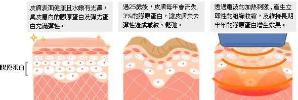 电波l皮除皱成好吗 电波l皮果图