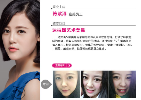 进口膨体,进口丰胸