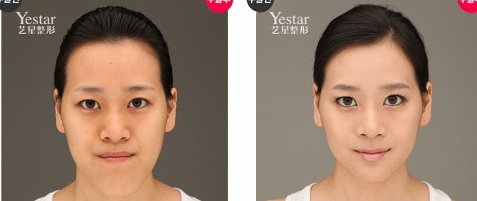 黄金美学改脸型好吗?瓜子脸你值得拥有!