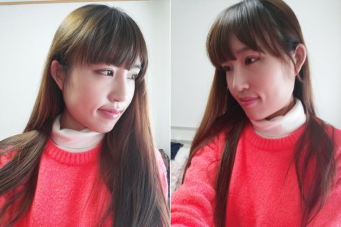 改变脸型的方法是什么?改脸型手术将会告诉您答案