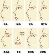 假体隆鼻是怎么做的 隆鼻的假体能取出来吗