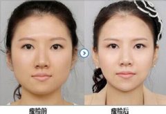 打B****可以永.久维持吗