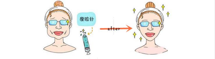 怎样在Z短时间内瘦脸