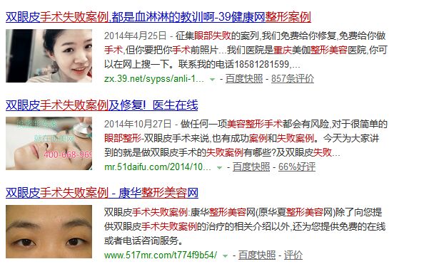 重庆眼部整形美容手术失败修复多少钱
